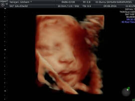 Four D (4D) Ultrasound 6